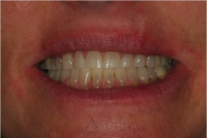 Kim's smile before